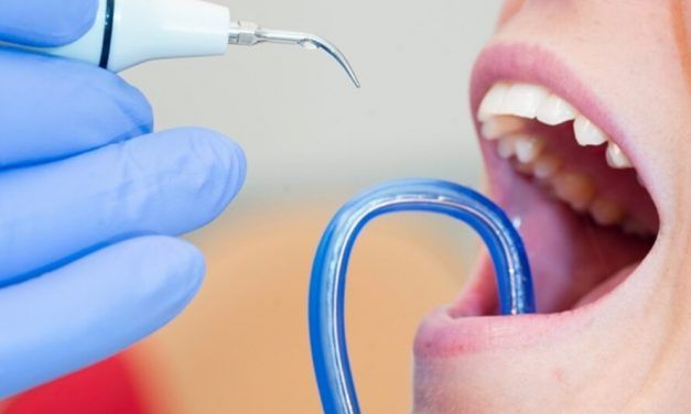 La importancia de una correcta limpieza dental