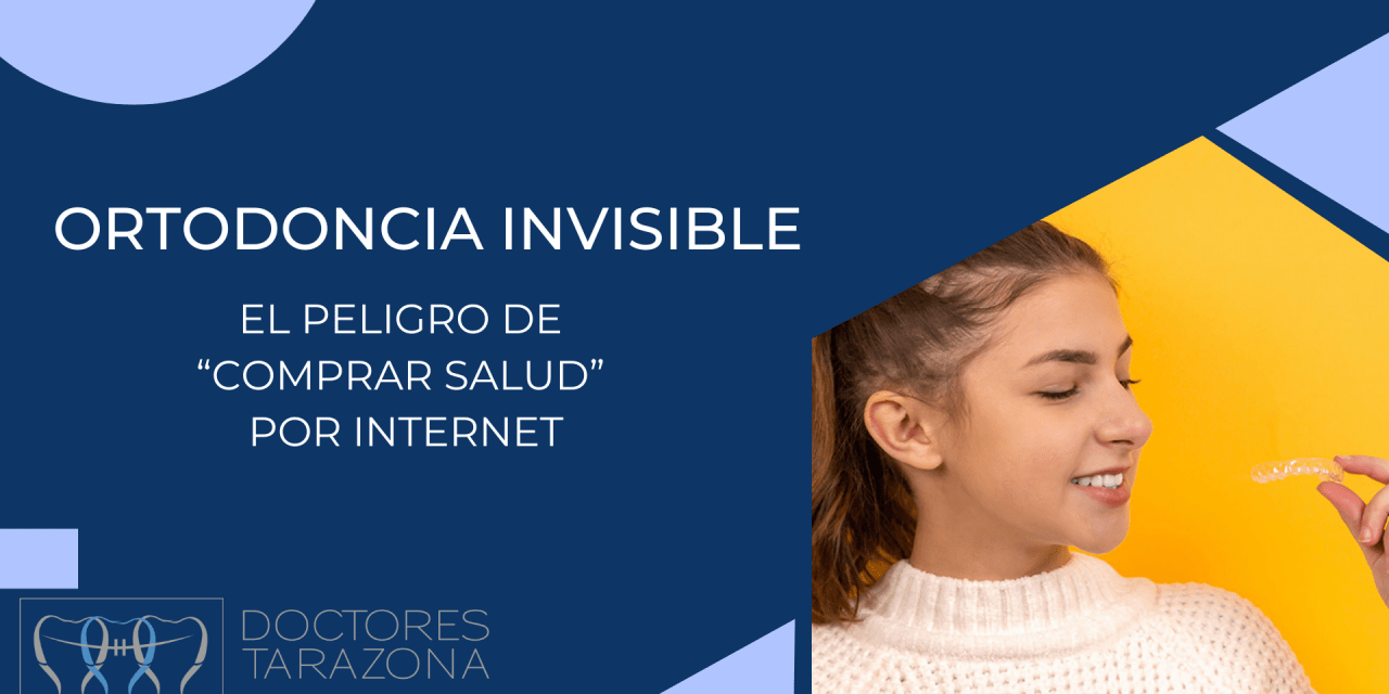 Ortodoncia Invisible: El peligro de “comprar salud” por internet