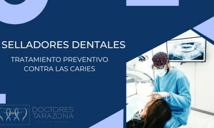 Tratamiento con Selladores Dentales