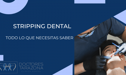 El stripping dental en ortodoncia: Todo lo que necesitas saber.