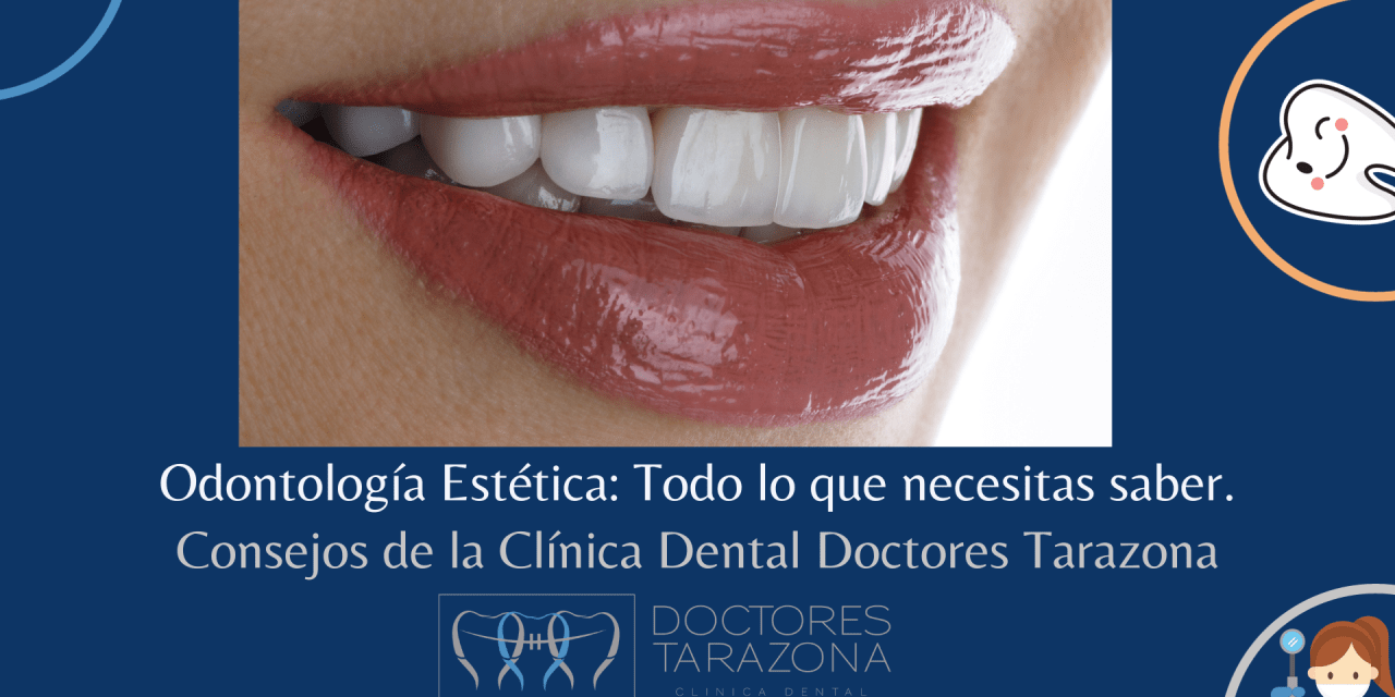 Odontología estética: todo lo que necesitas saber