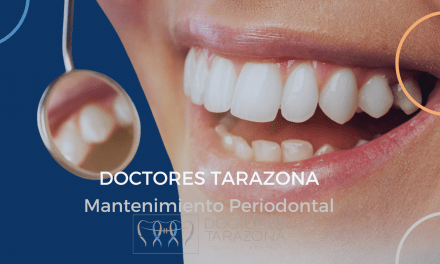 mantenimiento periodontal: cómo prevenir la recurrencia de la periodontitis