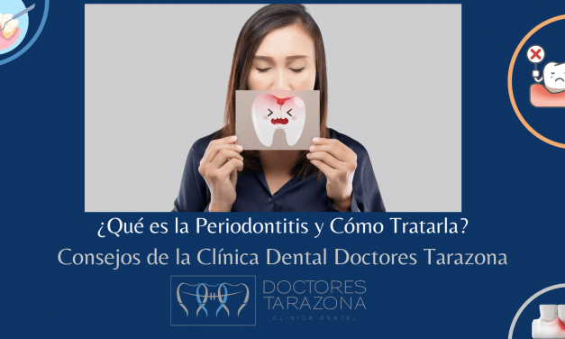 ¿Qué es la periodontitis y cómo tratarla?