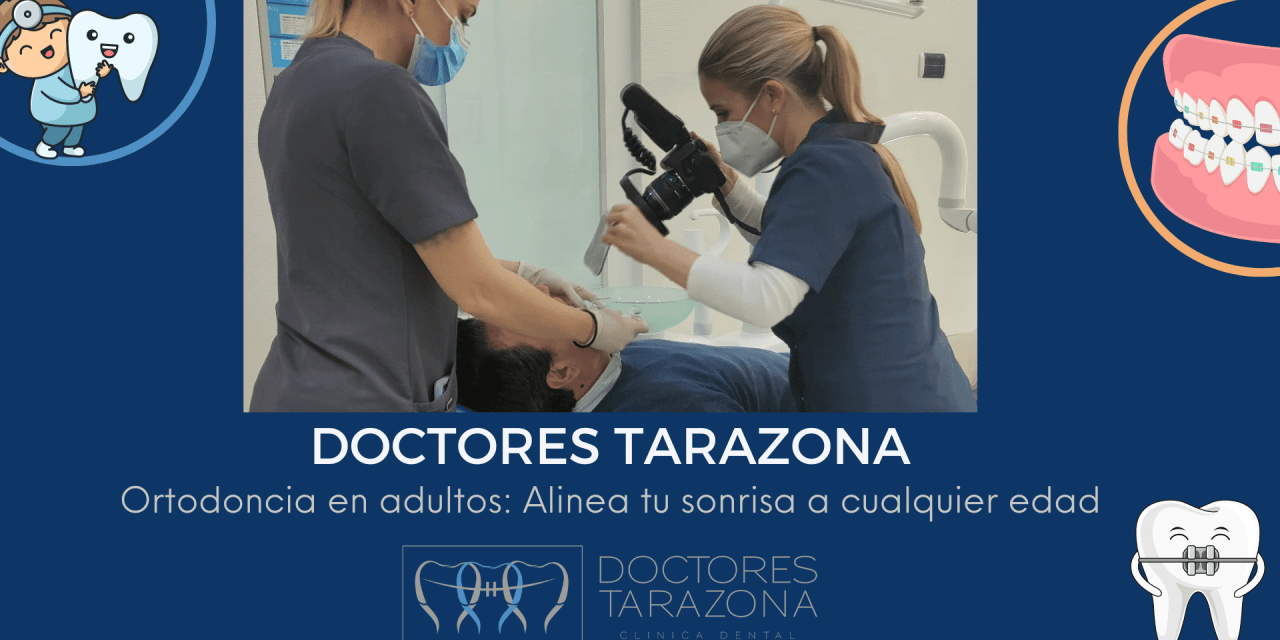 Ortodoncia en adultos: Alinea tu sonrisa a cualquier edad