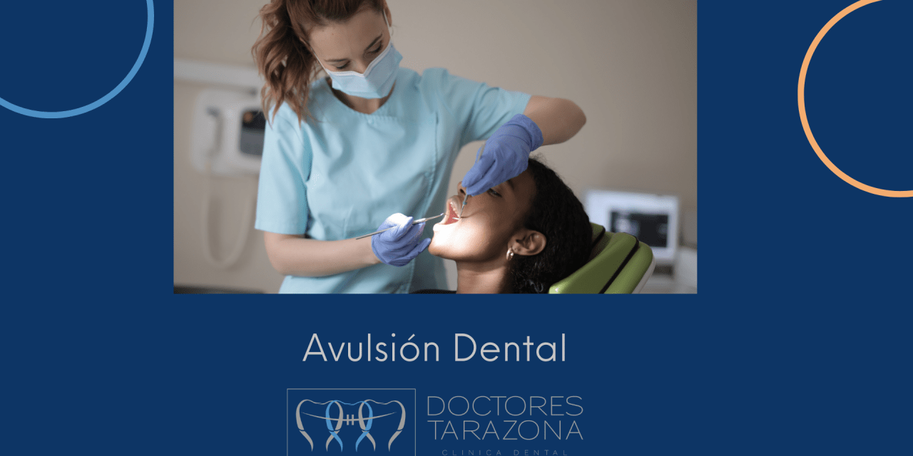 Cómo tratar una avulsión dental