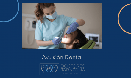 Cómo tratar una avulsión dental