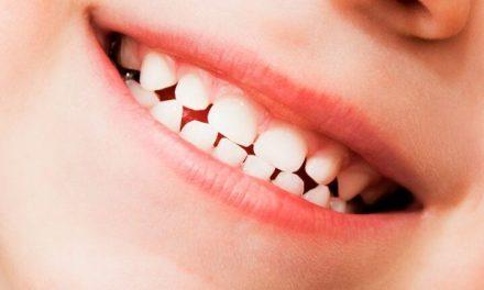 Por qué se caen los dientes de leche: todo lo que debes saber sobre este proceso natural