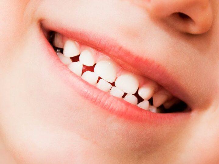 Por qué se caen los dientes de leche: todo lo que debes saber sobre este proceso natural