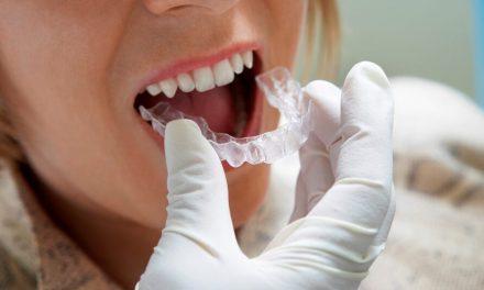 ¿Cuáles son las desventajas de la ortodoncia invisible? Descubre todo lo que debes saber antes de empezar tu tratamiento