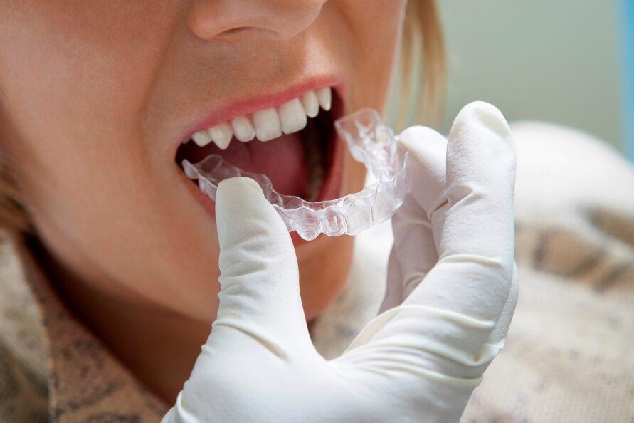 ¿Cuáles son las desventajas de la ortodoncia invisible? Descubre todo lo que debes saber antes de empezar tu tratamiento