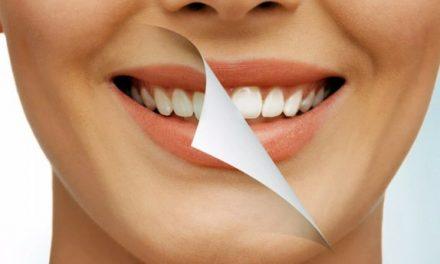 ¿Qué desventajas tiene el blanqueamiento dental? Descubre los riesgos antes de decidirte