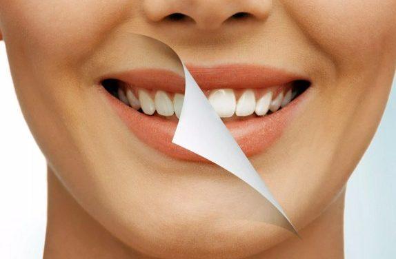 ¿Qué desventajas tiene el blanqueamiento dental? Descubre los riesgos antes de decidirte