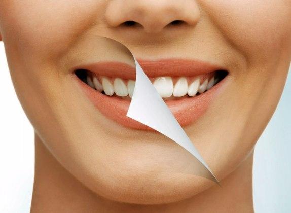 ¿Qué desventajas tiene el blanqueamiento dental? Descubre los riesgos antes de decidirte