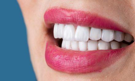 ¿Por qué se aflojan las coronas de los implantes? Causas, riesgos y soluciones