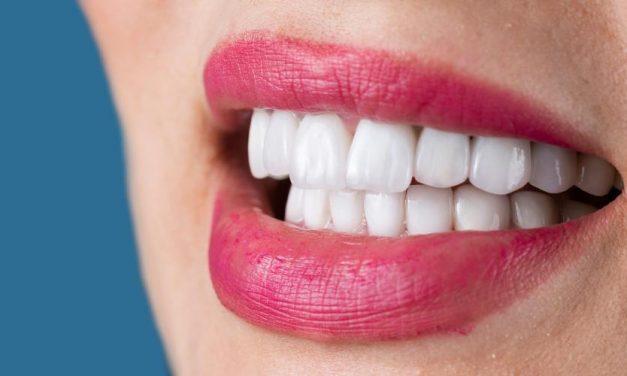 ¿Por qué se aflojan las coronas de los implantes? Causas, riesgos y soluciones