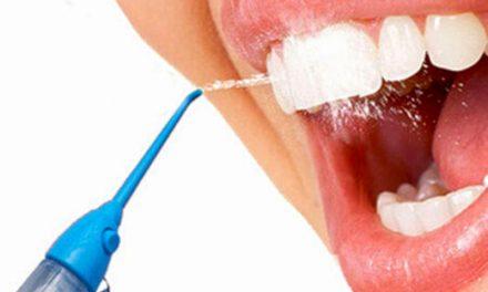 ¿Qué es un irrigador dental y por qué está revolucionando la higiene bucal?