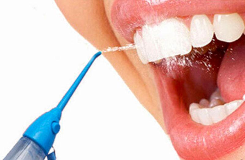 ¿Qué es un irrigador dental y por qué está revolucionando la higiene bucal?