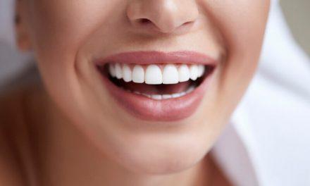 Carillas de composite o porcelana: ¿cuál es la mejor opción para tu sonrisa?
