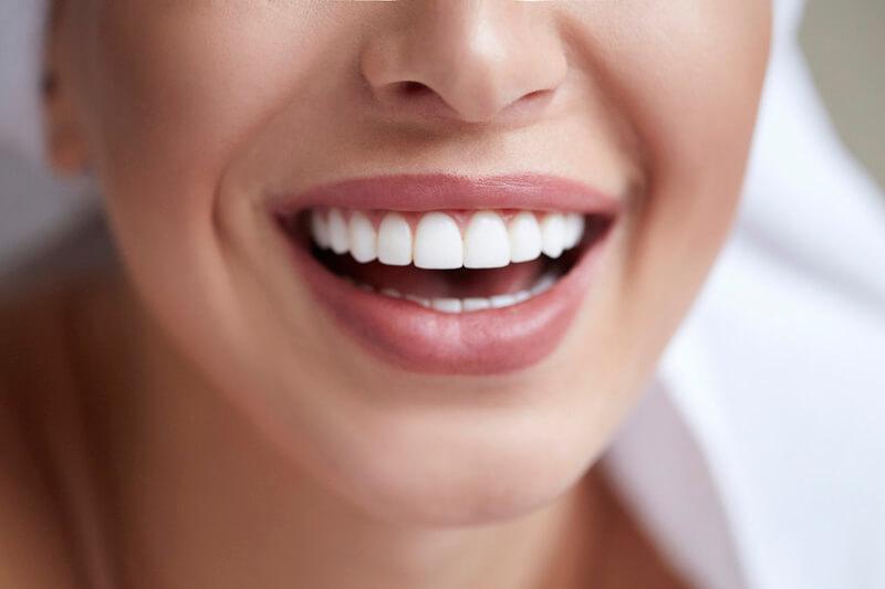 Carillas de composite o porcelana: ¿cuál es la mejor opción para tu sonrisa?