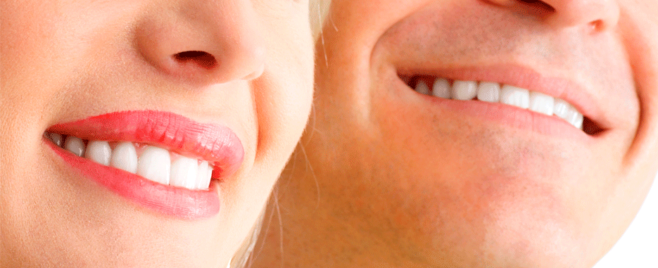 ¿Se te ve el tapón del implante dental? Descubre si es normal y qué hacer